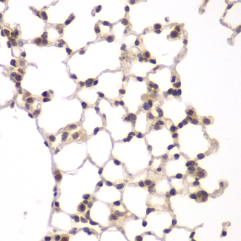 Immunohistochemistry of paraffin-embedded rat lung using VRK1 antibody at dilution of 1:100 (40x lens)