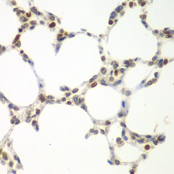 Immunohistochemistry of paraffin-embedded mouse lung using VRK1 antibody at dilution of 1:100 (40x lens)