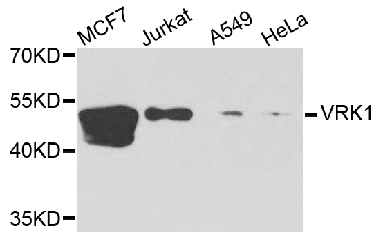 Western blot analysis of extracts of various cells, using VRK1 antibody