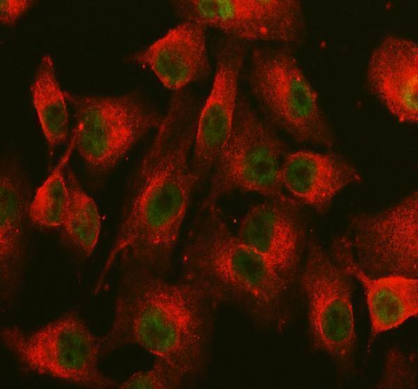  IF analysis of NCOA6 using anti-NCOA6 antibody (A03397) and anti-Beta Tubulin antibody (M01857-3)