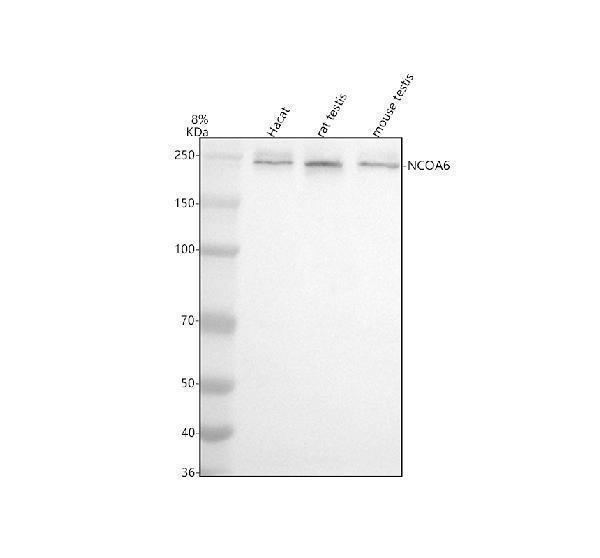  Western blot analysis of NCOA6 using anti-NCOA6 antibody (A03397)