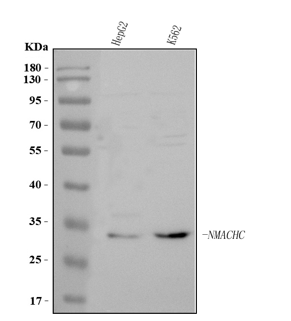  Western blot analysis of MMACHC using anti-MMACHC antibody (A03398-1)