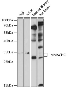 a03398 mmachc primary antiboties wb testing 1