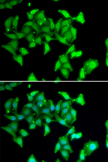 Immunofluorescence analysis of U20S cell using MYO1C antibody