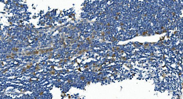 a03401 3 il2rb primary antibodies ihc testing 4