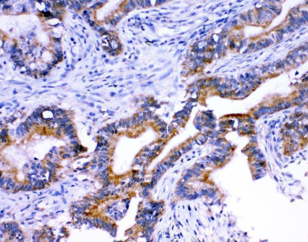  IHC analysis of Stanniocalcin 1/STC/STC1 using anti-Stanniocalcin 1/STC/STC1 antibody (A03402)