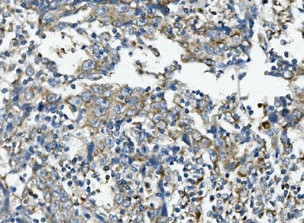 a03403 1 vps4b primary antibodies ihc testing 2