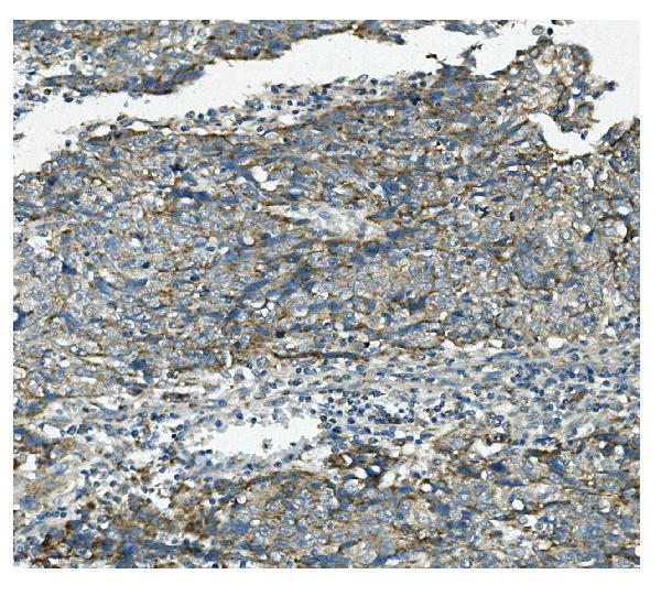 a03403 1 vps4b primary antibodies ihc testing 3