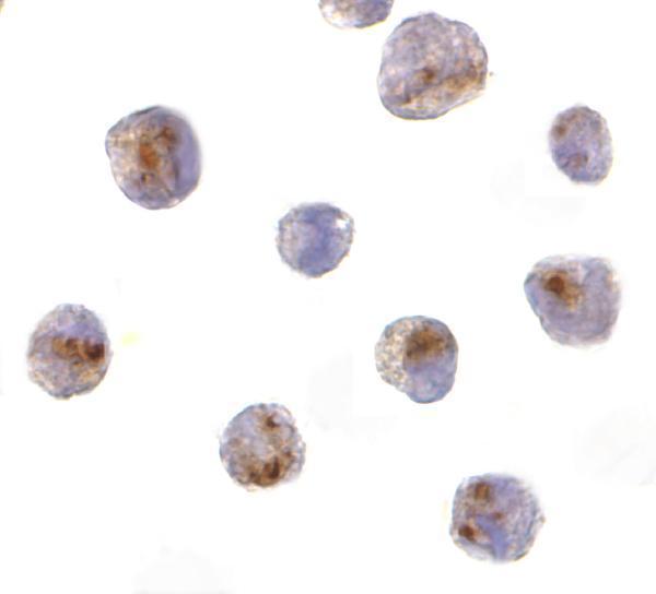 Immunocytochemistry of CARD8 in K562 cells with CARD8 antibody at 10 μg/mL