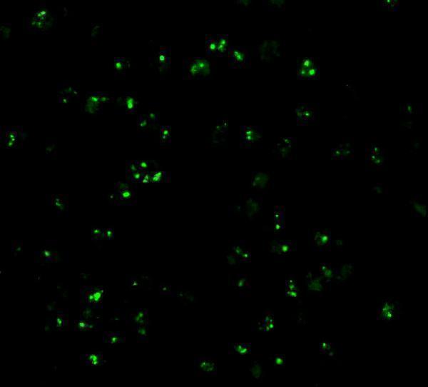 Immunofluorescence of CARD8 in K562 cells with CARD8 antibody at 20 μg/mL