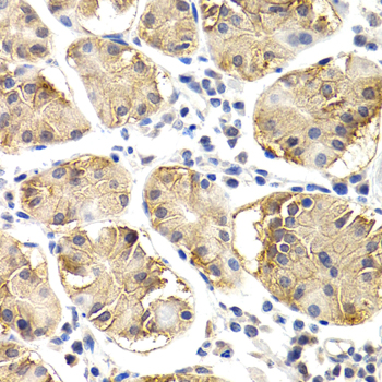 Immunohistochemistry of paraffin-embedded human normal stomach using CHIT1 antibody  at dilution of 1:200 