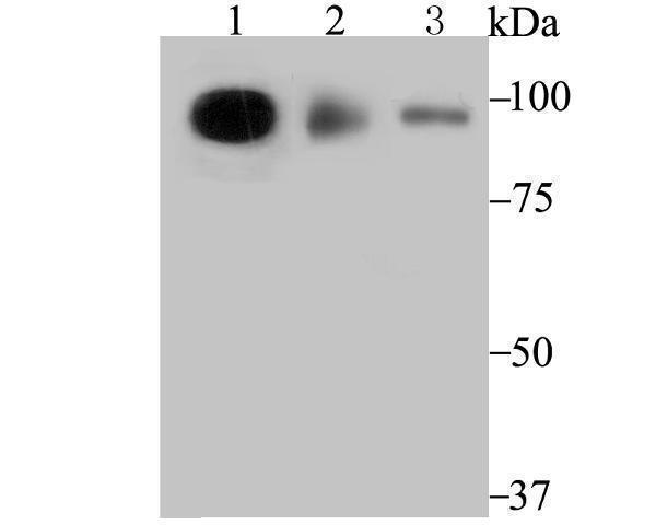 a03407 1 tnpo3 primary antiboties wb testing 1
