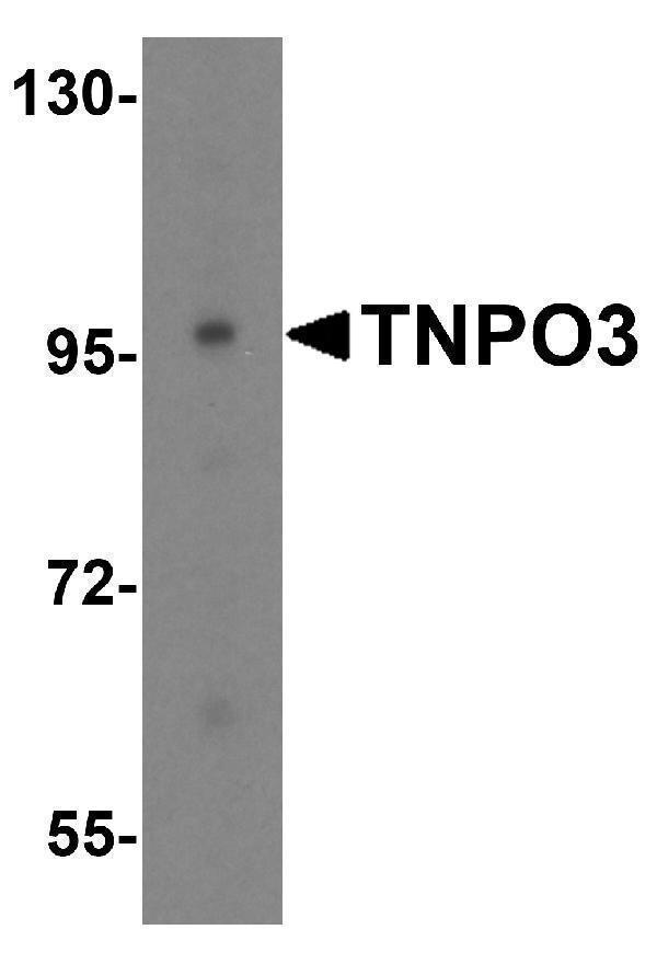 a03407 tnpo3 primary antibodies wb testing 1