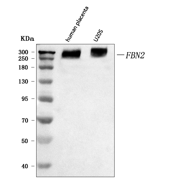  Western blot analysis of Fibrillin 2/FBN2 using anti-Fibrillin 2/FBN2 antibody (A03408-2)