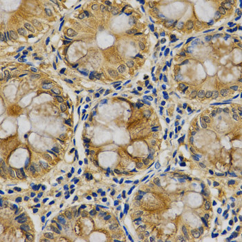 Immunohistochemistry (IHC) analysis of Maspin pAb in paraffin-embedded Human Colon tissue