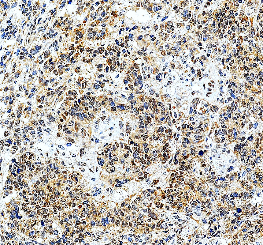 a03411 3 erf primary antibodies ihc testing 1