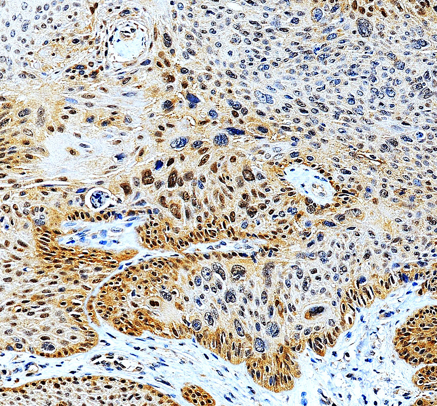 a03411 3 erf primary antibodies ihc testing 2