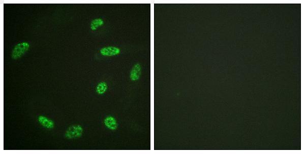 Immunofluorescence analysis of HeLa cells, using ERF Antibody