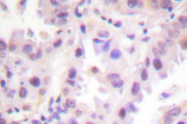 a03411t526 erf primary antiboties ihc testing 2