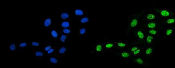 a03412 1 ccar2 primary antibodies if testing 11