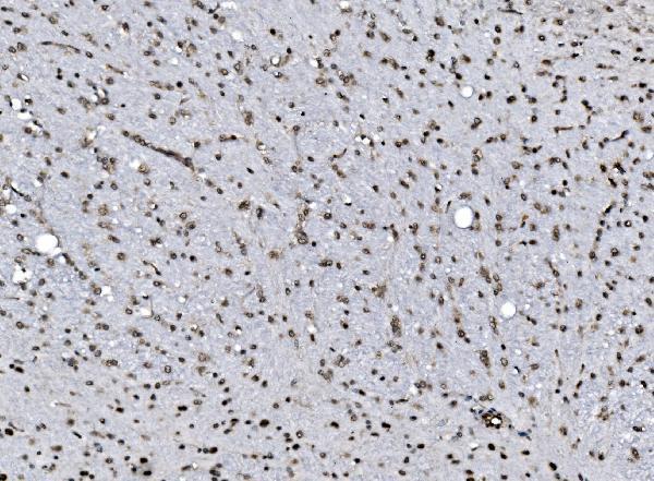 a03412 1 ccar2 primary antibodies ihc testing 10