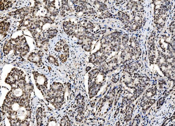  IHC analysis of DBC-1/CCAR2 using anti-DBC-1/CCAR2 antibody (A03412-1)