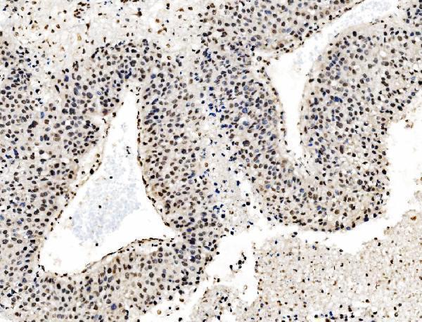  IHC analysis of DBC-1/CCAR2 using anti-DBC-1/CCAR2 antibody (A03412-1)