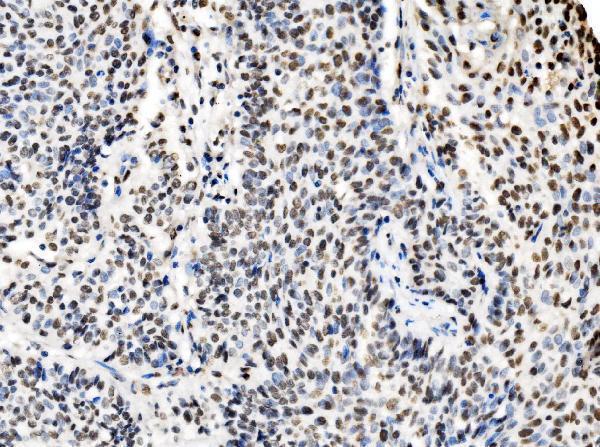 a03412 1 ccar2 primary antibodies ihc testing 4