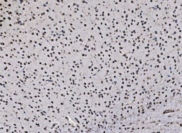 a03412 1 ccar2 primary antibodies ihc testing 5