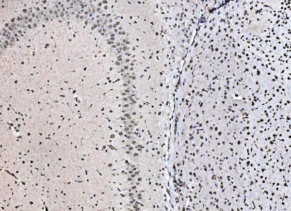 a03412 1 ccar2 primary antibodies ihc testing 6