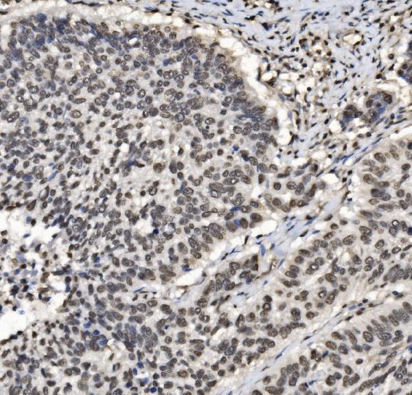 a03412 1 ccar2 primary antibodies ihc testing 7
