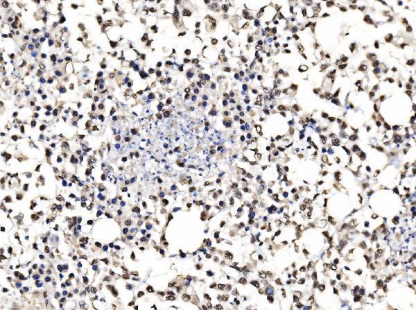 a03412 1 ccar2 primary antibodies ihc testing 8