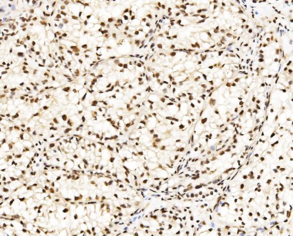 a03412 1 ccar2 primary antibodies ihc testing 9