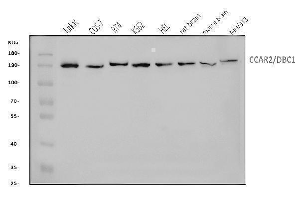  Western blot analysis of DBC-1/CCAR2 using anti-DBC-1/CCAR2 antibody (A03412-1)