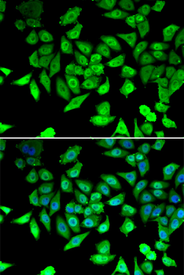 a03412 ccar2 primary antiboties ihc testing 2