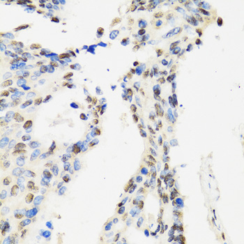 a03412 ccar2 primary antiboties ihc testing 3