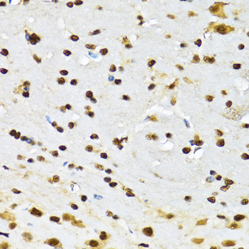 a03412 ccar2 primary antiboties ihc testing 4