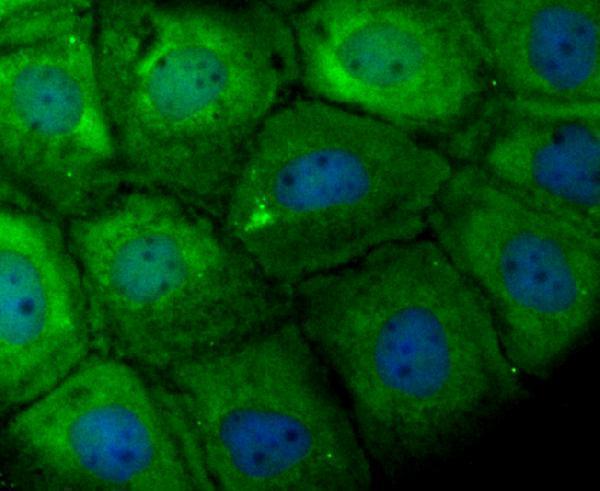 ICC staining TCTP in A431 cells (green)