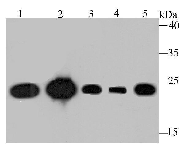 Western blot analysis of TCTP on different lysates using anti-TCTP antibody at 1/1,000 dilution