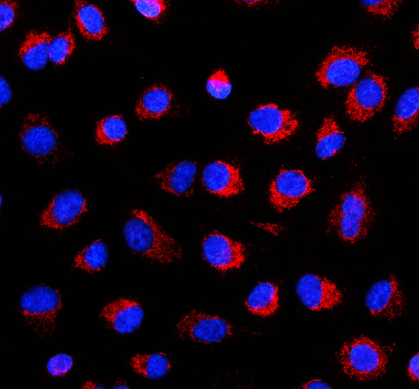 IF analysis of Galectin-9/LGALS9 using anti-Galectin-9/LGALS9 antibody (A03415-3)