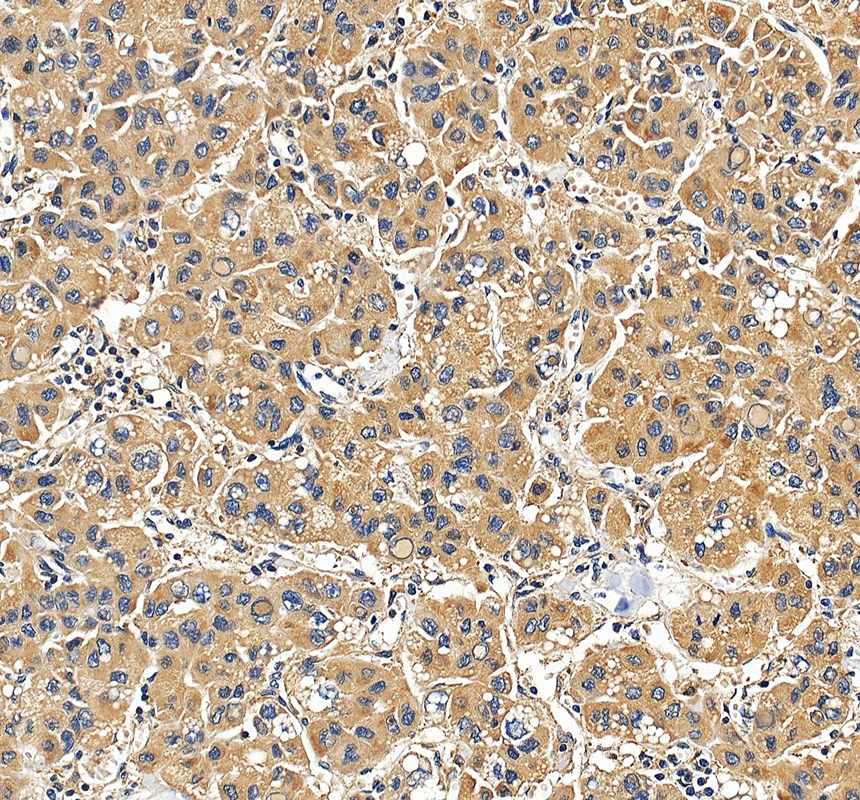 IHC analysis of Galectin-9/LGALS9 using anti-Galectin-9/LGALS9 antibody (A03415-3)