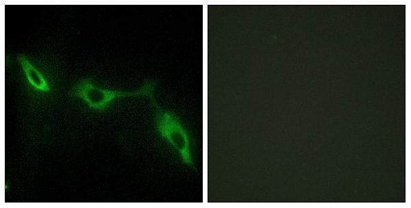 a03415 lgals9 primary antibodies if testing 1