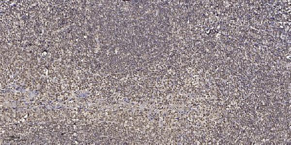 a03415 lgals9 primary antibodies ihc testing 4