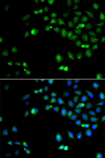 Immunofluorescence analysis of A549 cell using HOXA1 antibody