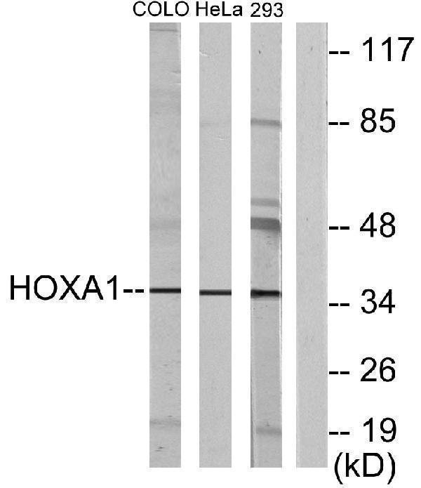 Western blot analysis of lysates from HeLa, COLO, and 293 cells, using HOXA1 Antibody