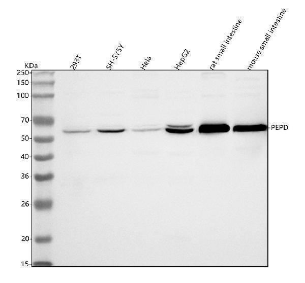  Western blot analysis of PEPD using anti-PEPD antibody (A03417-1)