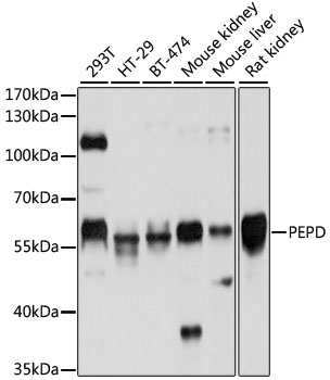 Western blot analysis of extracts of various cell lines, using PEPD antibody  at 1:1000 dilution