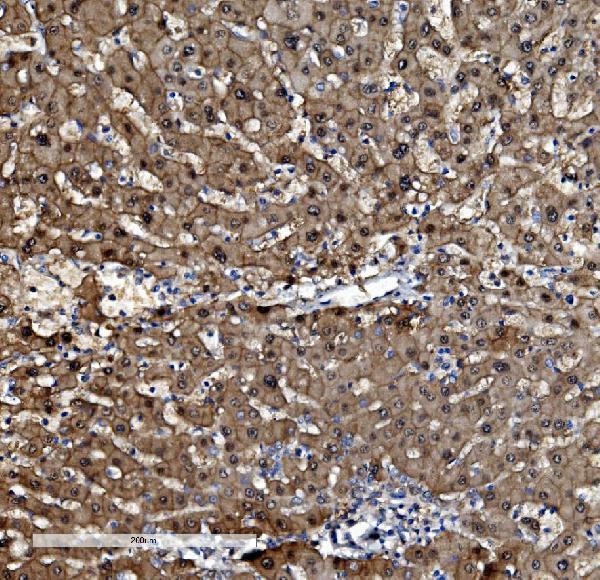 a03418 1 psmb5 primary antibodies ihc testing 3