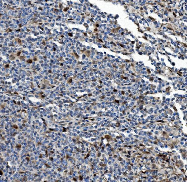 a03418 1 psmb5 primary antibodies ihc testing 4