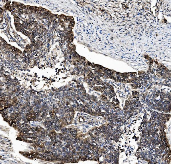 a03418 1 psmb5 primary antibodies ihc testing 5